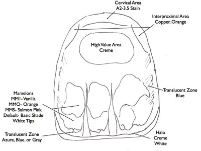 Example of a dental color map.